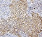 Anti-SQSTM1/p62 Antibody Picoband™ (monoclonal, 3H11)